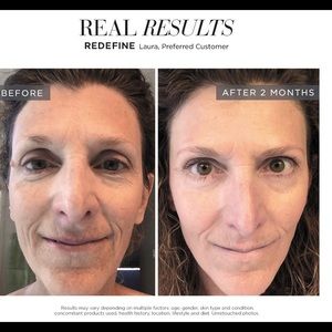 Rodan + Fields Skincare: Redefine Regimen